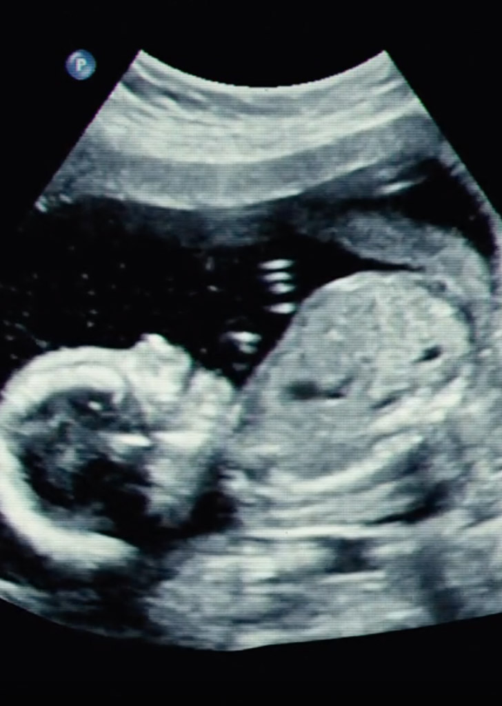 Midwifery Video Poster